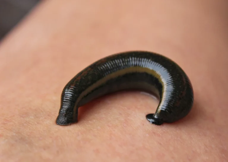 Foto von Blutegeltherapie Nr. 3